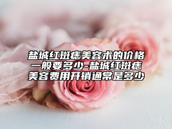 鹽城紅斑痣美容術(shù)的價(jià)格一般要多少-鹽城紅斑痣美容費(fèi)用開銷通常是多少