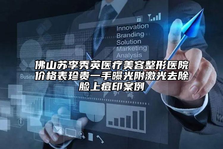佛山蘇李秀英醫(yī)療美容整形醫(yī)院價格表珍貴一手曝光附激光去除臉上痘印案例