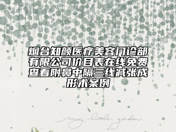 煙臺(tái)知顏醫(yī)療美容門診部有限公司價(jià)目表在線免費(fèi)查看附鼻中隔三線減張成形術(shù)案例