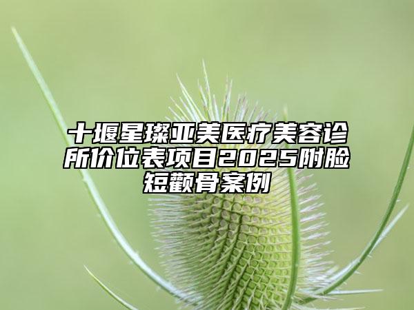 十堰星璨亞美醫(yī)療美容診所價位表項目2025附臉短顴骨案例