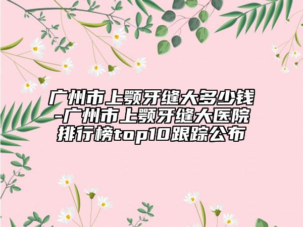 廣州市上顎牙縫大多少錢(qián)-廣州市上顎牙縫大醫(yī)院排行榜top10跟蹤公布