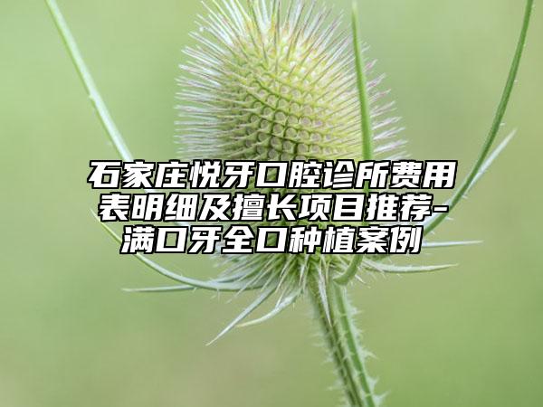 石家莊悅牙口腔診所費(fèi)用表明細(xì)及擅長項(xiàng)目推薦-滿口牙全口種植案例