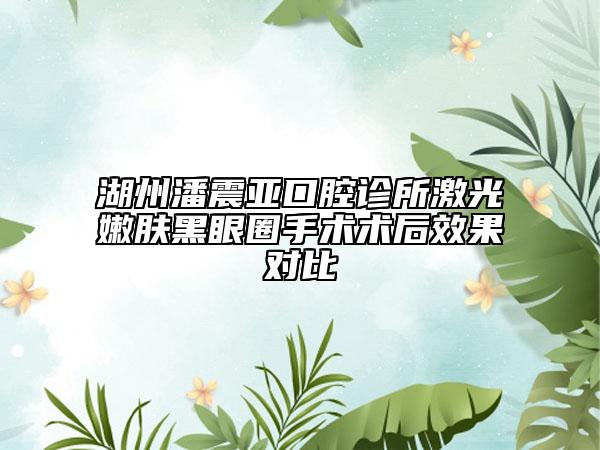 湖州潘震亞口腔診所激光嫩膚黑眼圈手術(shù)術(shù)后效果對比
