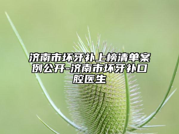 濟(jì)南市壞牙補(bǔ)上榜清單案例公開-濟(jì)南市壞牙補(bǔ)口腔醫(yī)生