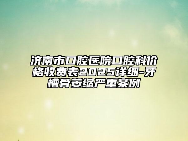 濟(jì)南市口腔醫(yī)院口腔科價(jià)格收費(fèi)表2025詳細(xì)-牙槽骨萎縮嚴(yán)重案例