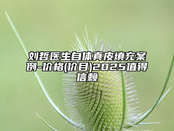 劉哲醫(yī)生自體真皮填充案例-價格(價目)2025值得信賴