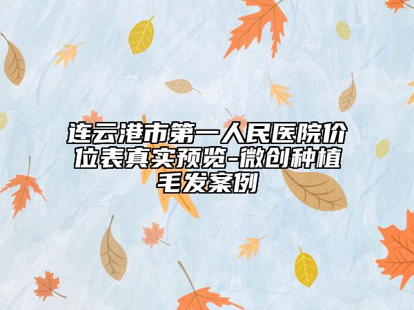 連云港市第一人民醫(yī)院價(jià)位表真實(shí)預(yù)覽-微創(chuàng)種植毛發(fā)案例