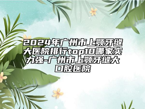 2024年廣州市上顎牙縫大醫(yī)院排行top10哪家實力強-廣州市上顎牙縫大口腔醫(yī)院
