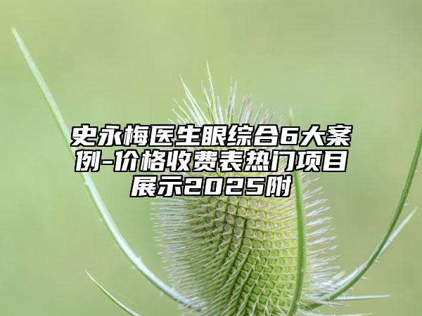 史永梅醫(yī)生眼綜合6大案例-價格收費(fèi)表熱門項(xiàng)目展示2025附