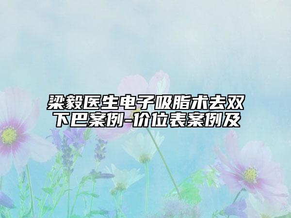 梁毅醫(yī)生電子吸脂術(shù)去雙下巴案例-價位表案例及