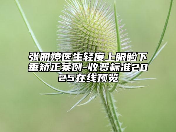 張麗婷醫(yī)生輕度上眼瞼下垂矯正案例-收費(fèi)標(biāo)準(zhǔn)2025在線預(yù)覽