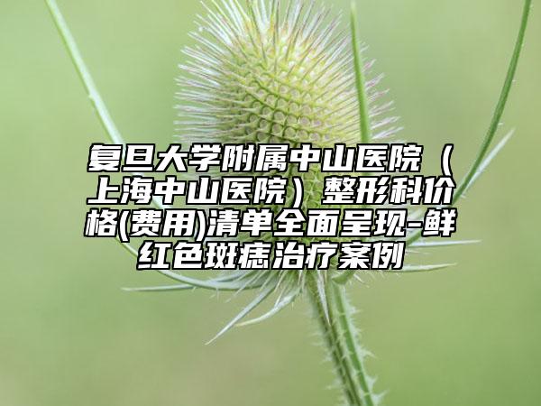 復(fù)旦大學(xué)附屬中山醫(yī)院（上海中山醫(yī)院）整形科價格(費用)清單全面呈現(xiàn)-鮮紅色斑痣治療案例
