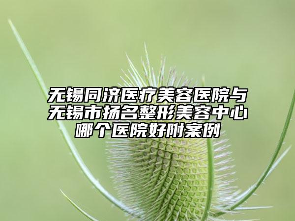無(wú)錫同濟(jì)醫(yī)療美容醫(yī)院與無(wú)錫市揚(yáng)名整形美容中心哪個(gè)醫(yī)院好附案例