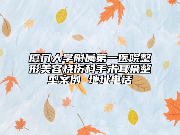 廈門大學(xué)附屬第一醫(yī)院整形美容燒傷科手術(shù)耳朵整型案例 地址電話