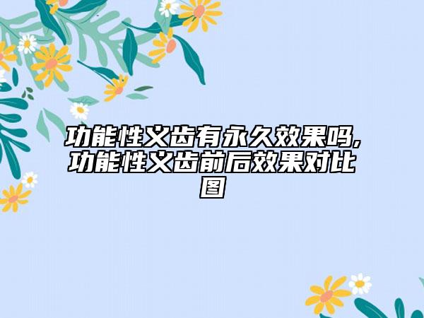 功能性義齒有永久效果嗎,功能性義齒前后效果對(duì)比圖
