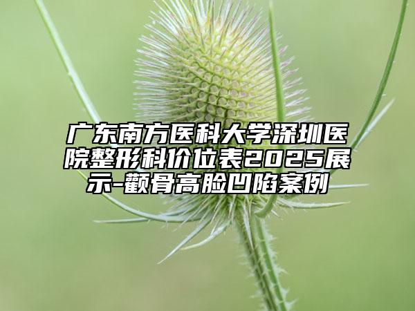 廣東南方醫(yī)科大學(xué)深圳醫(yī)院整形科價(jià)位表2025展示-顴骨高臉凹陷案例