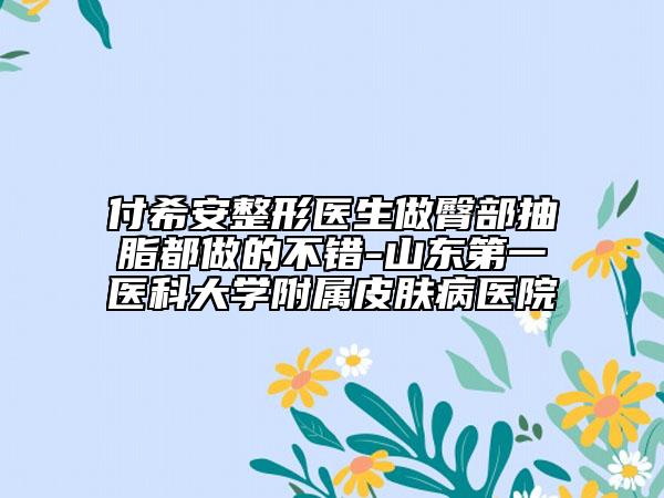 付希安整形醫(yī)生做臀部抽脂都做的不錯(cuò)-山東第一醫(yī)科大學(xué)附屬皮膚病醫(yī)院